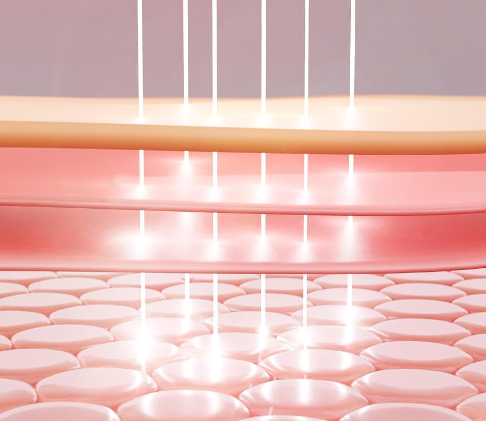 MIRACL™ Superior Precision