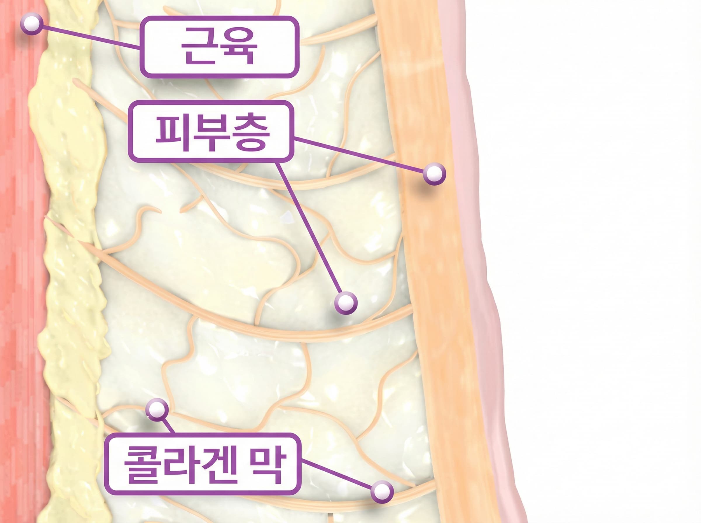 RF Heat Focus Technology